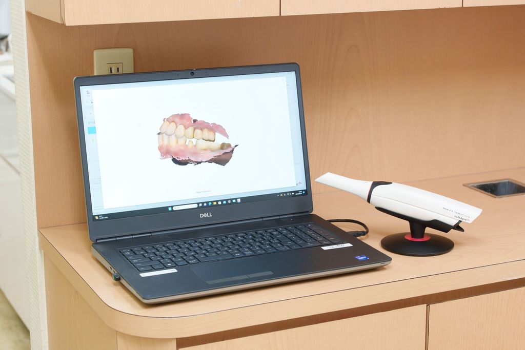 光学スキャナー(TRIOS)